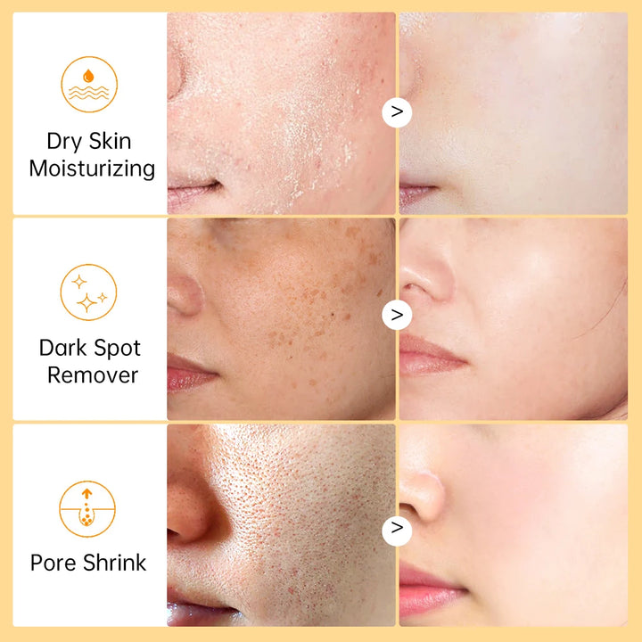 Vitamin C Serum for Face Dark Spot Remover Hyaluronic Acid Whitening Fade Melanin Anti Wrinkle Facial Serum Skin Care Product
