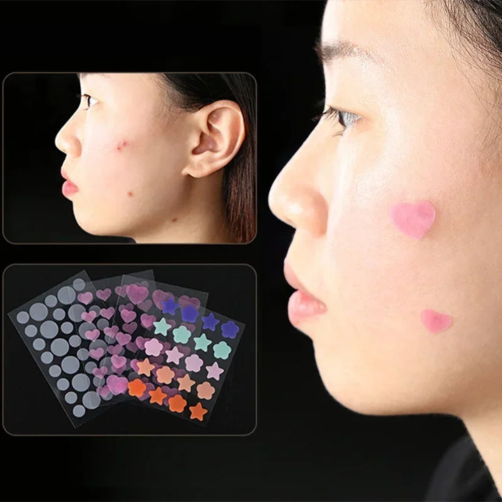 Star Pimple Patch Acne Colorful Invisible Acne Removal Skin Care