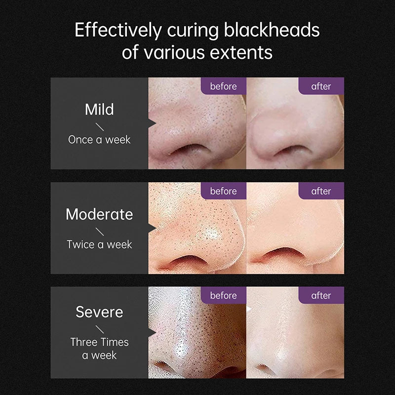 AUQUEST Blackhead Remover Black Dots Facial Masks NoseBamboo Charcoal Point Pimple Anti Acne Spot Face Skin Care Beauty Health